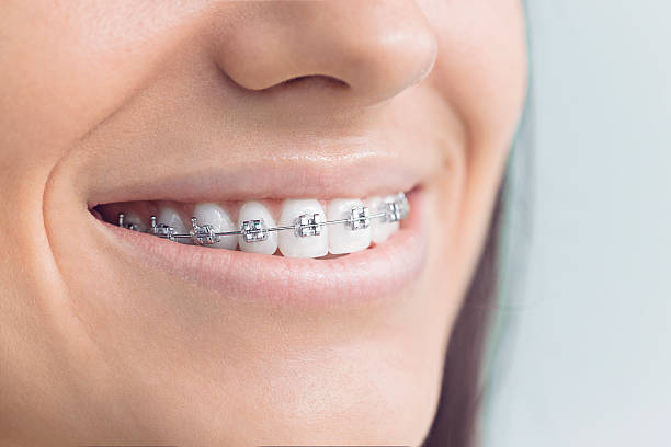 Best Traditional Braces  in Green Forest, AR